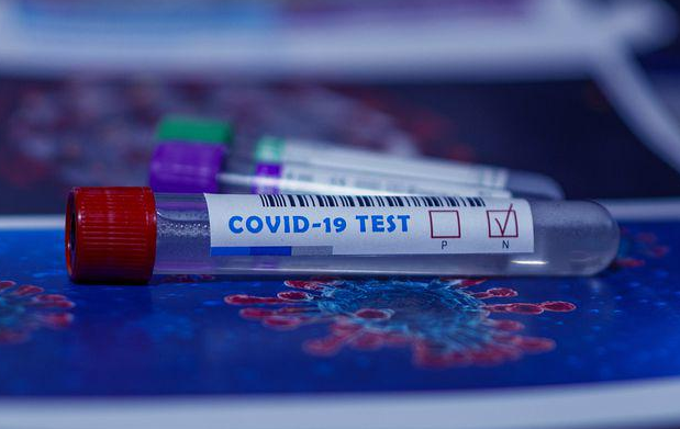 <big><strong><span style="color: #ff9900;">New EEOC guidance limits employers’ ability to test employees for COVID-19</span></strong></big>